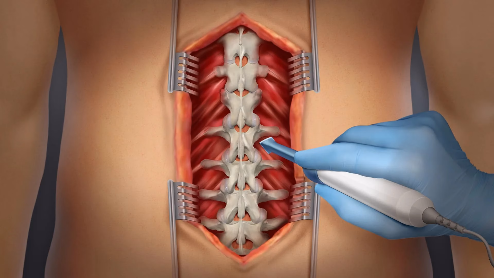 Healthcare Animation: Explaining Complex Medical Products